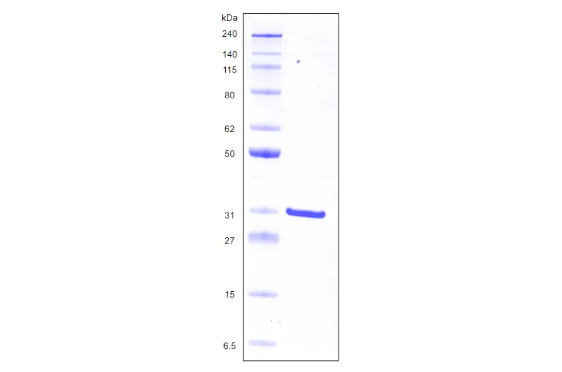 Recombinant Human Galectin 3, His Tag -25 ug